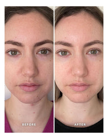 Vitamin B With 5% Niacinamide Serum 25ml