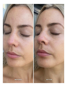 Vtiamin E With 1% Ceramide Complex Serum 25ml