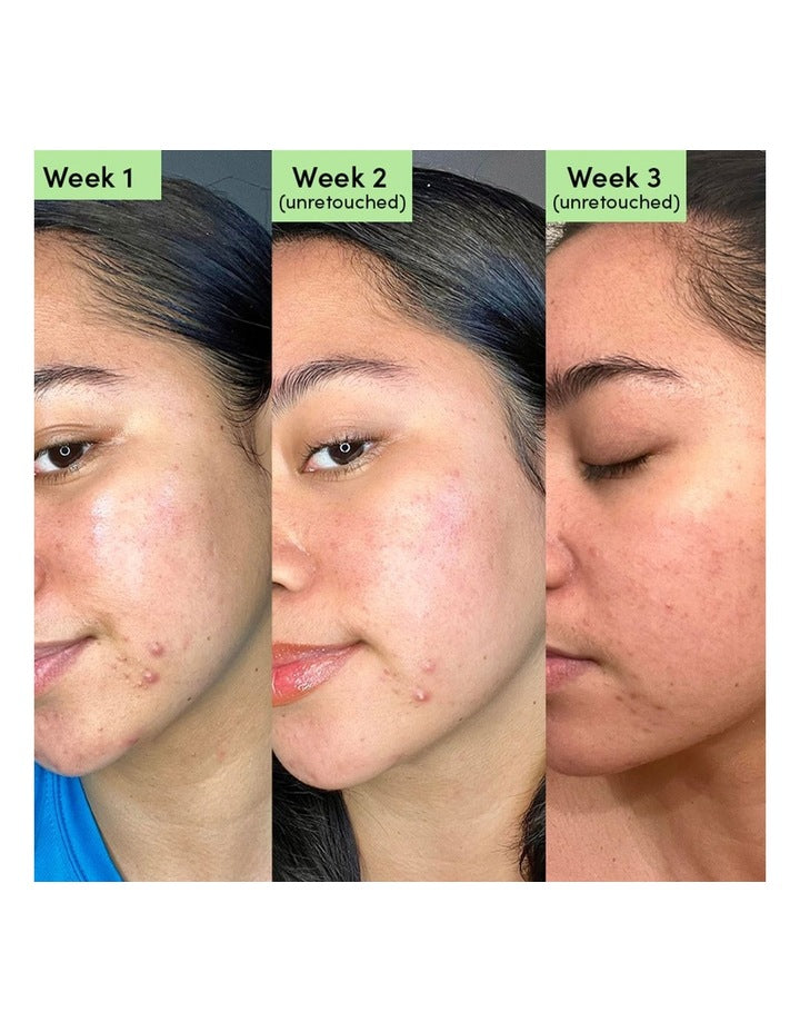 Oil Control Clearing Face Mask