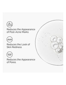Aloe 2% + NAG 2% Solution - Soothing and Lightweight Hydration for Post-Acne Marks 30ml