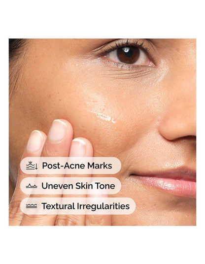 Aloe 2% + NAG 2% Solution - Soothing and Lightweight Hydration for Post-Acne Marks 30ml