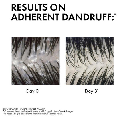 Dercos Anti-Dandruff Shampoo for Sensitive Scalp 200ml