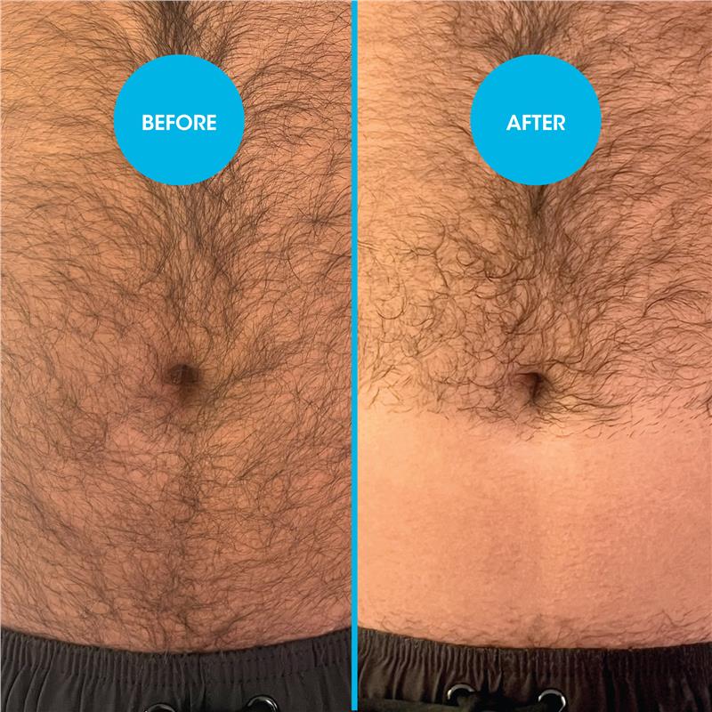 Nad's for Men Down Under Hair Removal Cream 150ml