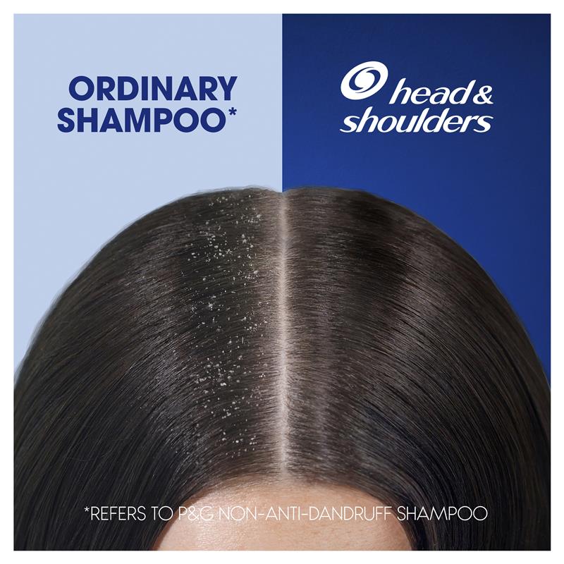 Head & Shoulders Ultra Men 2in1 Moisture Recharge Anti Dandruff Shampoo + Conditioner 750ml