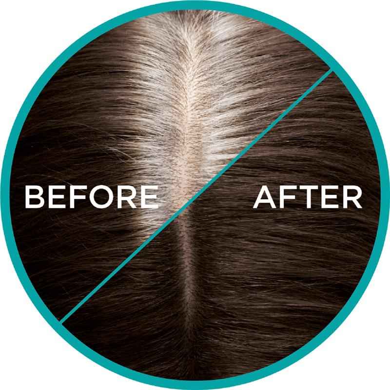 L'Oreal Paris Magic Retouch Temporary Root Concealer Spray - Dark Brown(Instant Grey Hair Coverage)