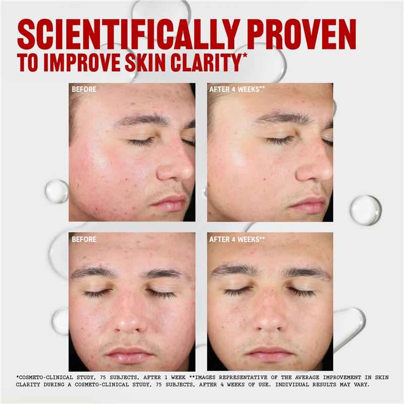 Thayers Anti-Blemish Toner 355ml