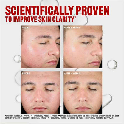 Thayers Anti-Blemish Toner 355ml