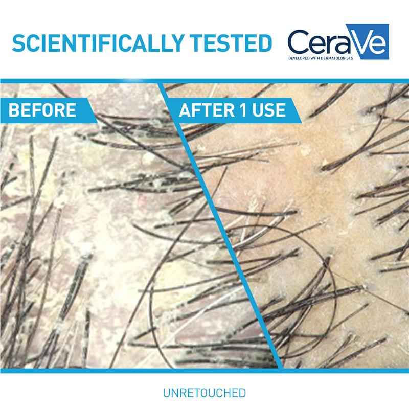 CeraVe Hair Anti-Dandruff Hydrating Shampoo 355ml