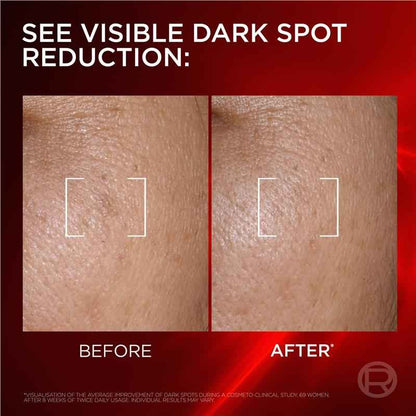 L'Oreal Paris Revitalift Laser Dark Spot Creamy-Serum 50ml