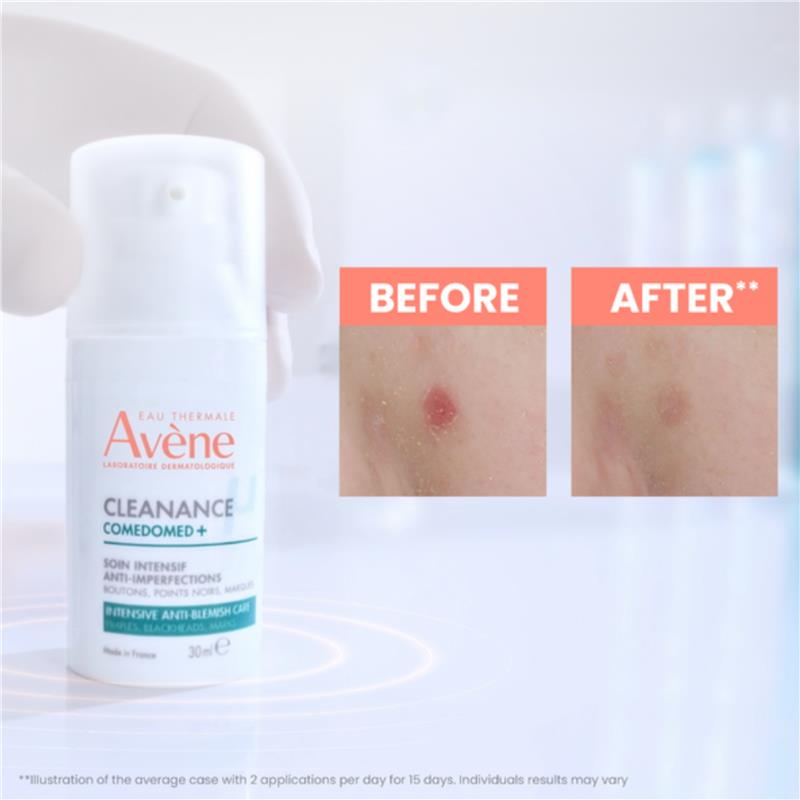 Avene Cleanance Starter Kit - For Oily skin