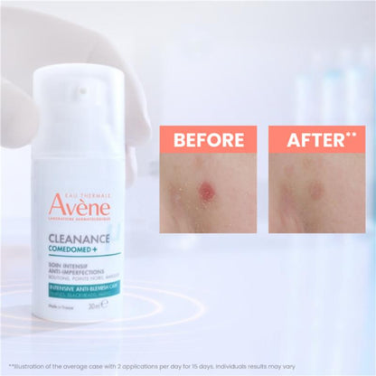 Avene Cleanance Starter Kit - For Oily skin