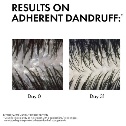 Dercos Anti-Dandruff DS Shampoo for Normal to Oily Hair 200ml