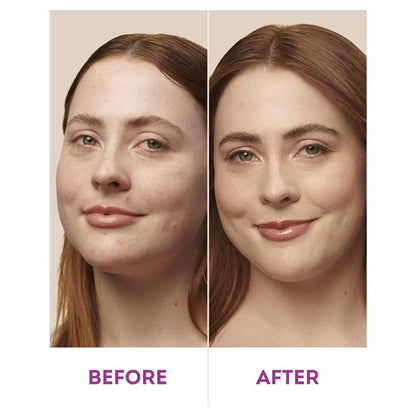 Nude By Nature Natural Mineral Cover Blemish Control Light 10g