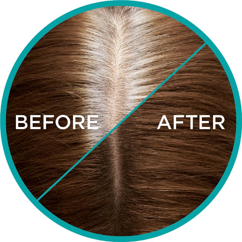 L'Oreal Paris Magic Retouch Temporary Root Concealer Spray - Brown(Instant Grey Hair Coverage)