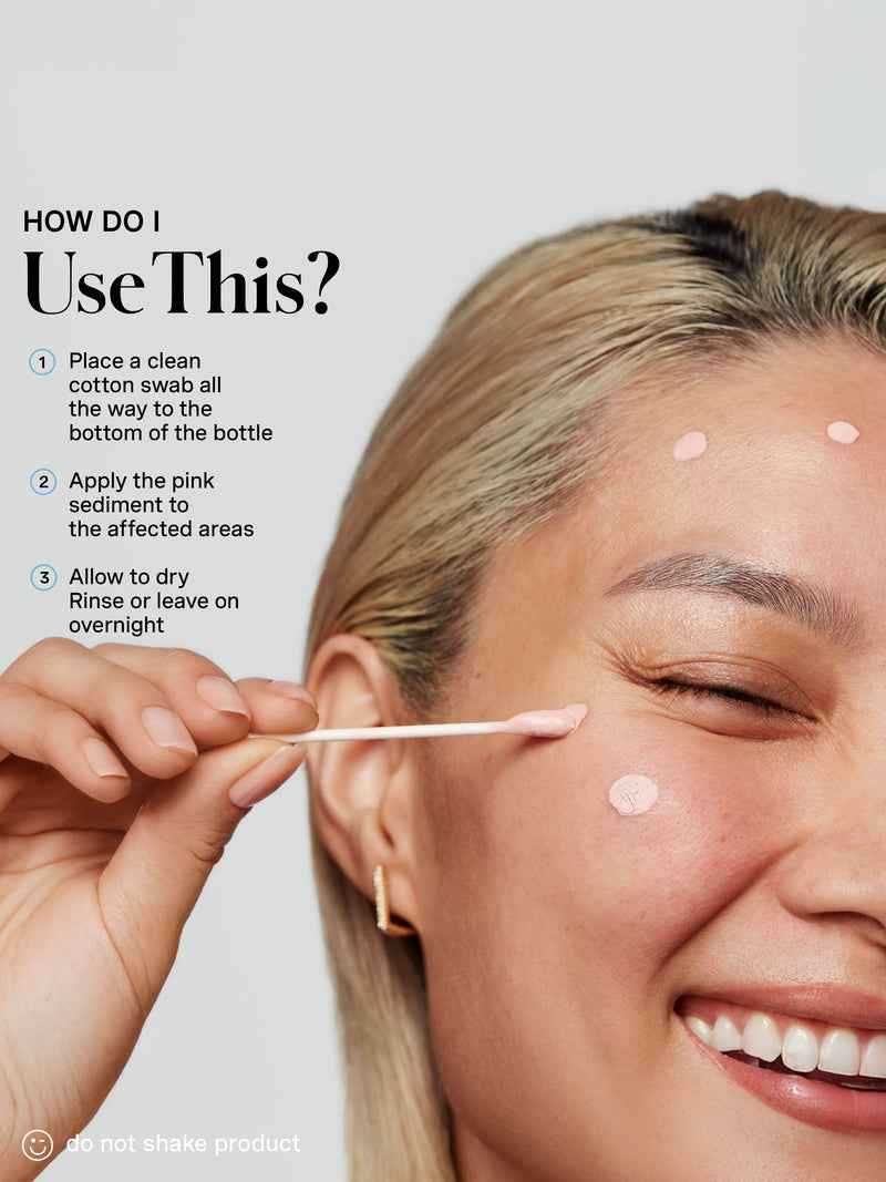 EradiKate Acne Treatment