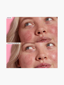 Avocado Ceramide Recovery Serum