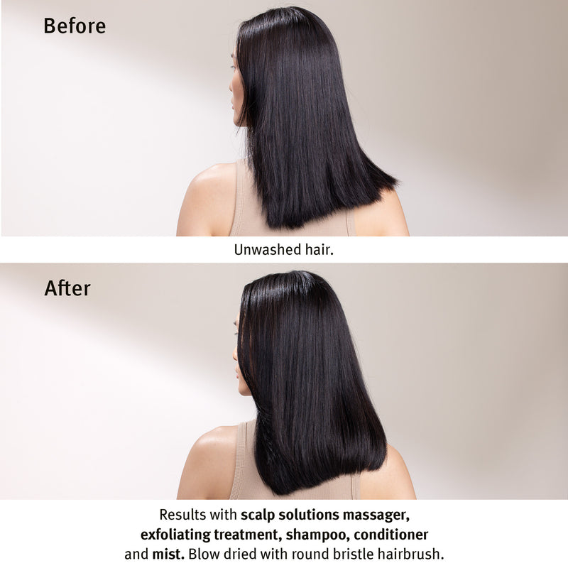 Scalp Solutions Stimulating Scalp Massager