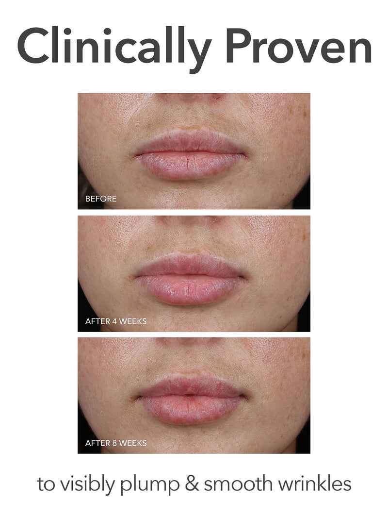 DRx Spectralite LipWare Pro