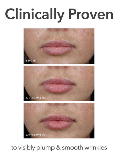 DRx Spectralite LipWare Pro