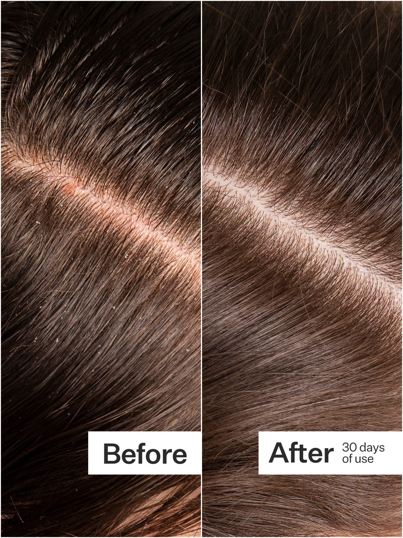Microbiome Cooling Scalp Serum