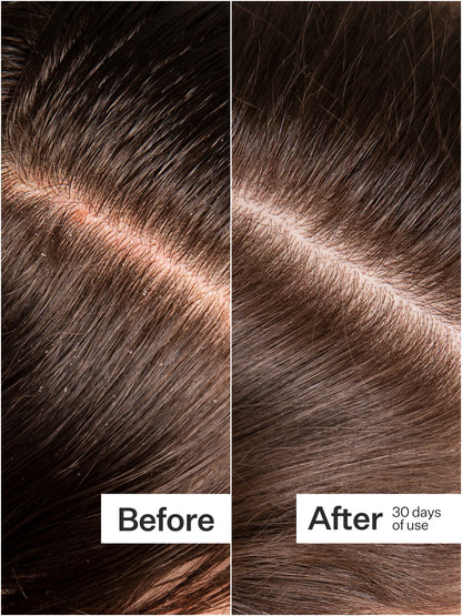 Microbiome Cooling Scalp Serum
