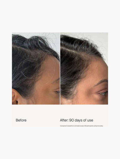 Scalp Care Density Serum