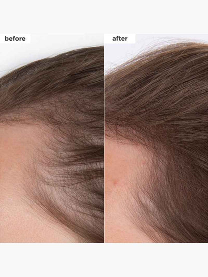 Destined For Density™ MegaStrength+ Caffeine + Biotin Peptide Density Serum