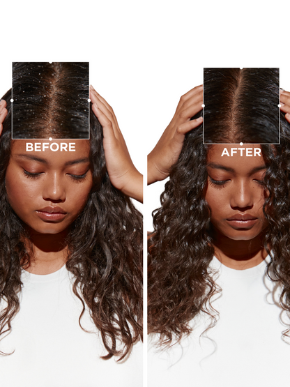 Symbiose Purifying Anti-Dandruff Cellular Shampoo for Oily Scalp