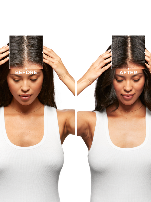 Symbiose Moisturising Anti-Dandruff Cellular Shampoo for Dry Scalp