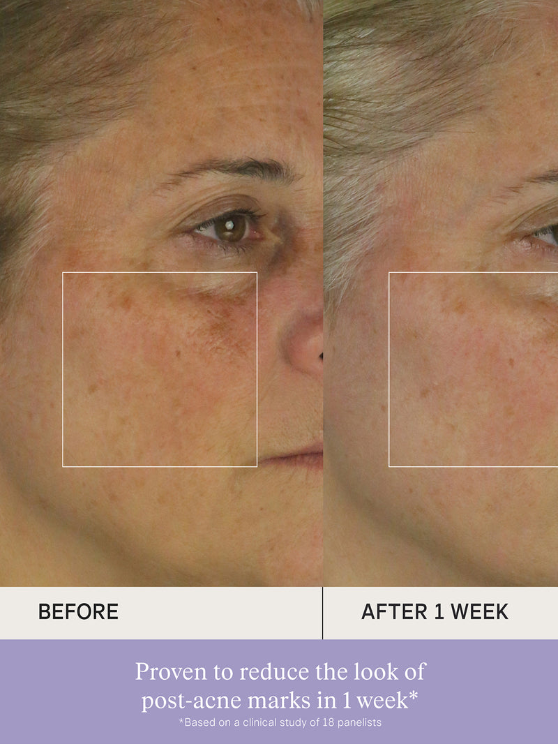 The Brightening Serum