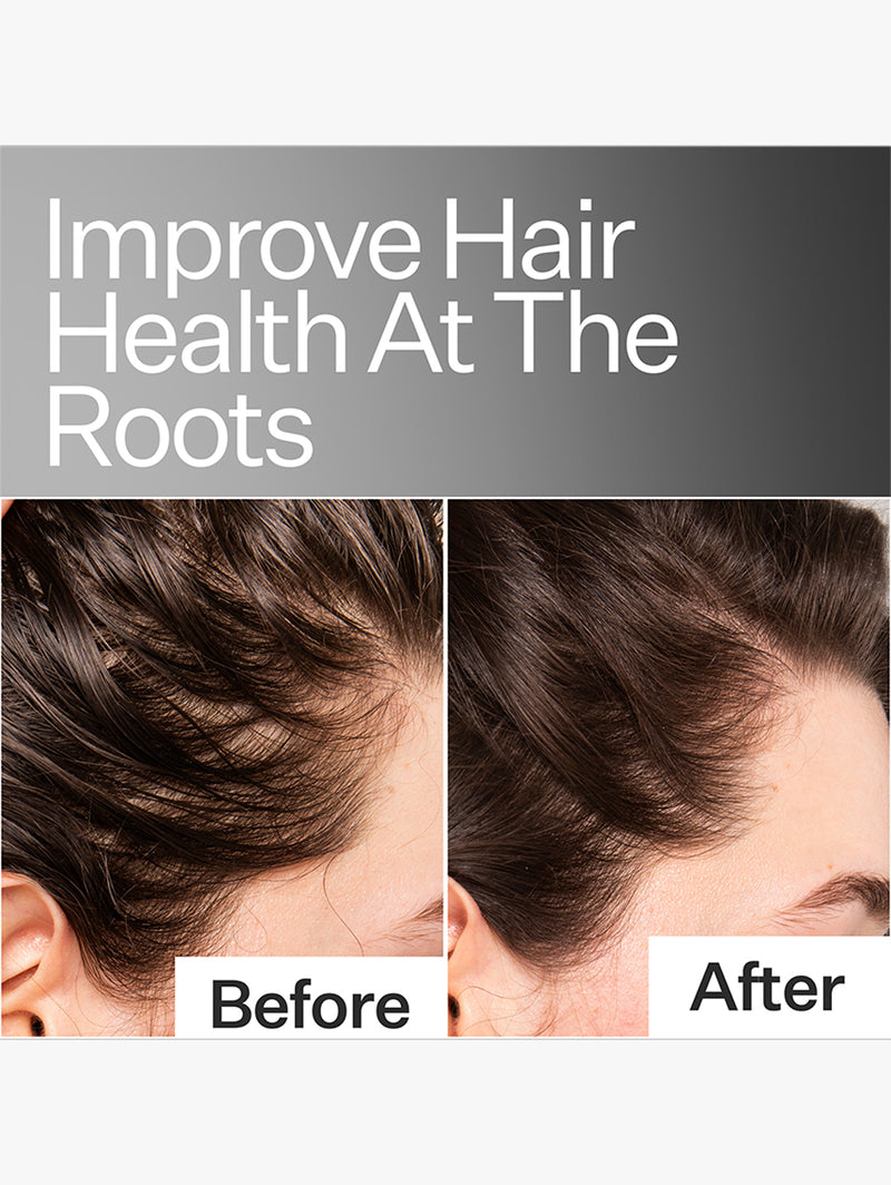 Scalp Relief System