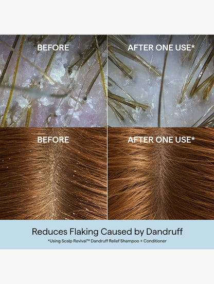 Scalp Revival™ Dandruff Relief Shampoo