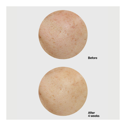 Moisture Surge Hydro-Infused Lotion - 200ml