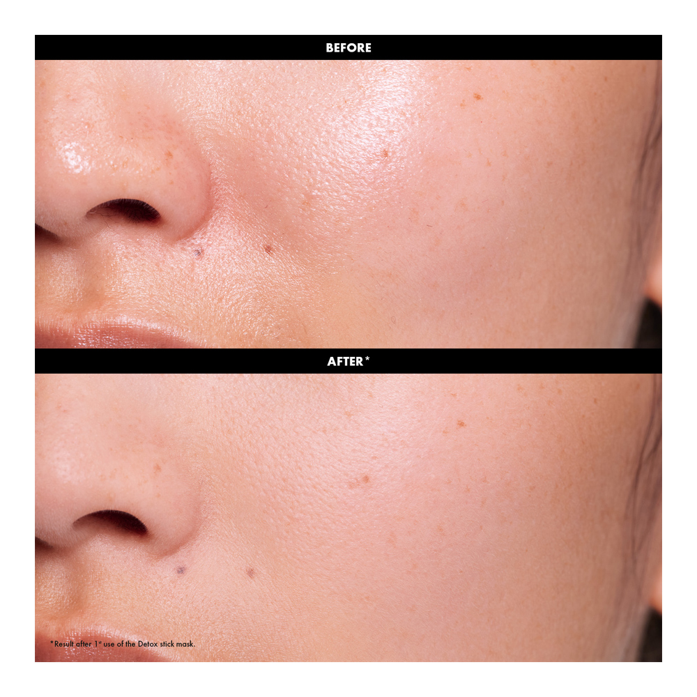 Detox Mask - 20g