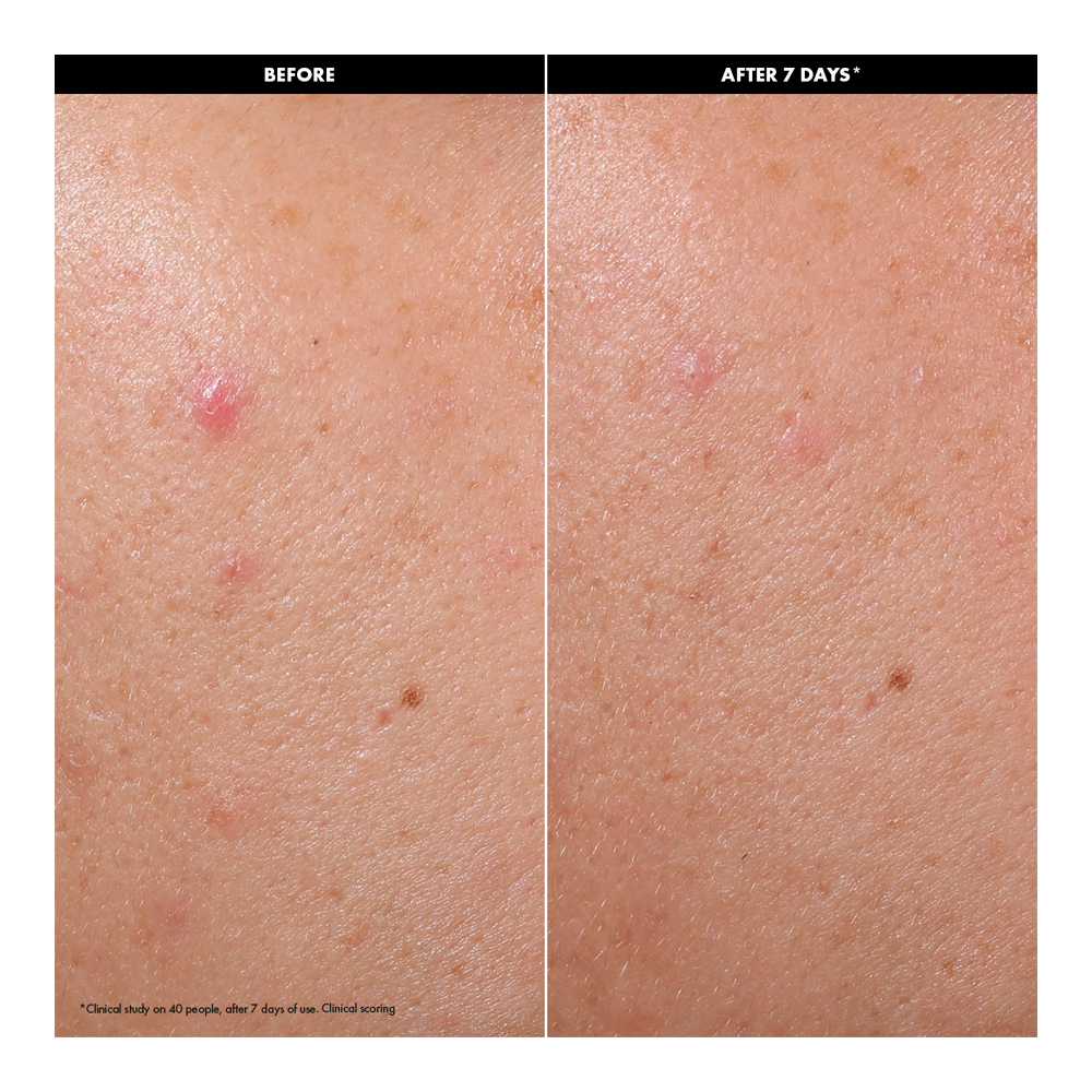 Clear & Purify Skin Serum - 30ml