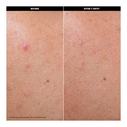 Clear & Purify Skin Serum - 30ml
