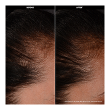 Hair Density - Strengthening & Densifying Serum - 50ml