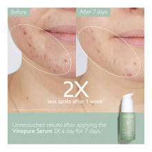 Vinopure Blemish Control Salicylic Serum - 30ml