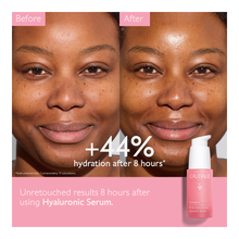 VinoHydra Hyaluronic Serum - 30ml