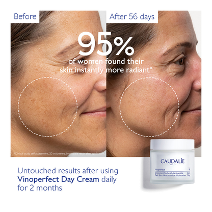 Vinoperfect Dark Spot Niacinamide Moisturizer Refill - 50ml