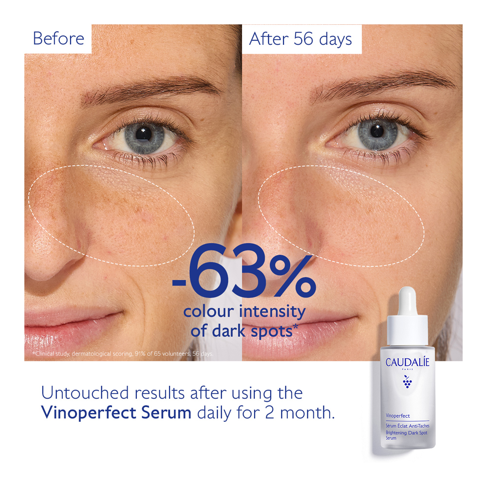 Vinoperfect Dark Spot Brightening Set