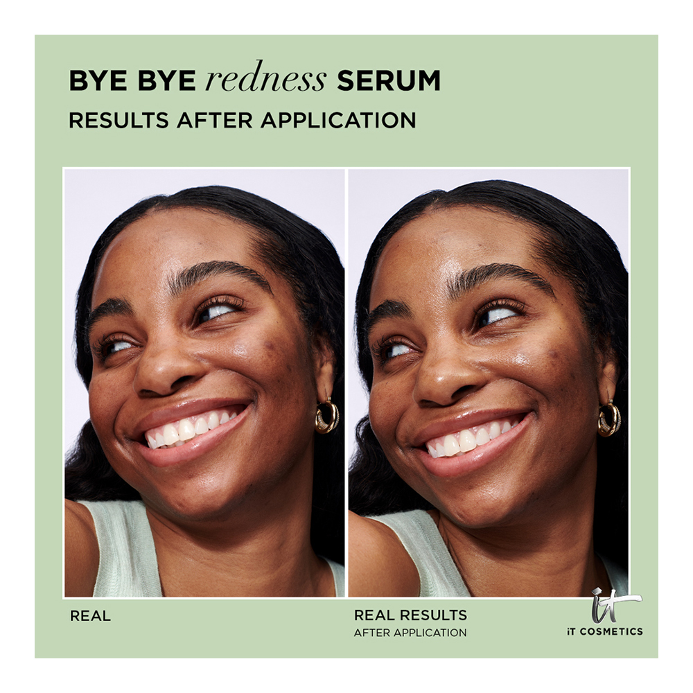 Bye Bye Redness Concentrated Derma Serum - 30ml