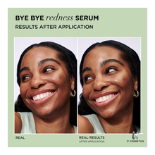 Bye Bye Redness Concentrated Derma Serum - 30ml