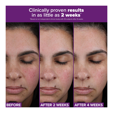 Clinical Pro Retinaldehyde Treatment - 30ml