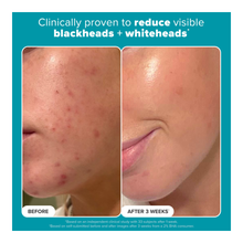 2% BHA Liquid Exfoliant - 118ml