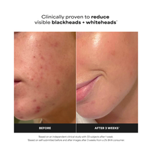 Skin Perfecting 2% BHA Liquid Exfoliant - 118ml