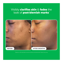 10% Azelaic Acid Booster - 30ml
