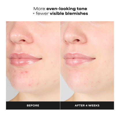 1% BHA Gentle Exfoliating Gel Toner - 100ml