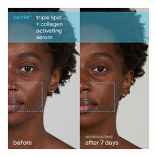 Triple Lipid + Collagen Activating Serum - 30ml
