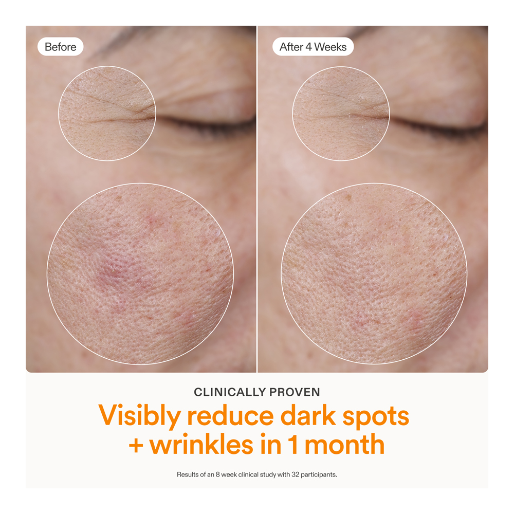 Brighten + Firm 15% Vitamin C Serum - 30ml